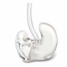 Full Shell Custom Ear Mould